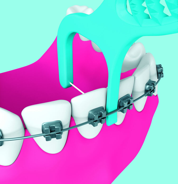 Piksters Supagrip for Braces (20 Pack)
