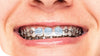Piksters Braces Wax Dots (12 Pack)