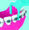 Piksters Supagrip for Braces (20 Pack)