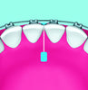 Piksters Supagrip for Braces (20 Pack)
